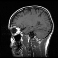 image for Traces of human growth hormone found in Jackson body