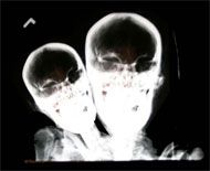 image for Barbara Bush's Ulcer Named W