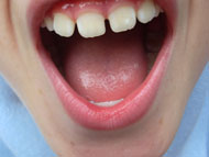 image for Mesothelioma Cured - Lawyers Panic