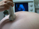 Funny story:  Jennifer Aniston nude pic exclusive!